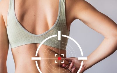 Cryolipolyse, radio-fréquence, HIFU ou liposuccion – le comparatif