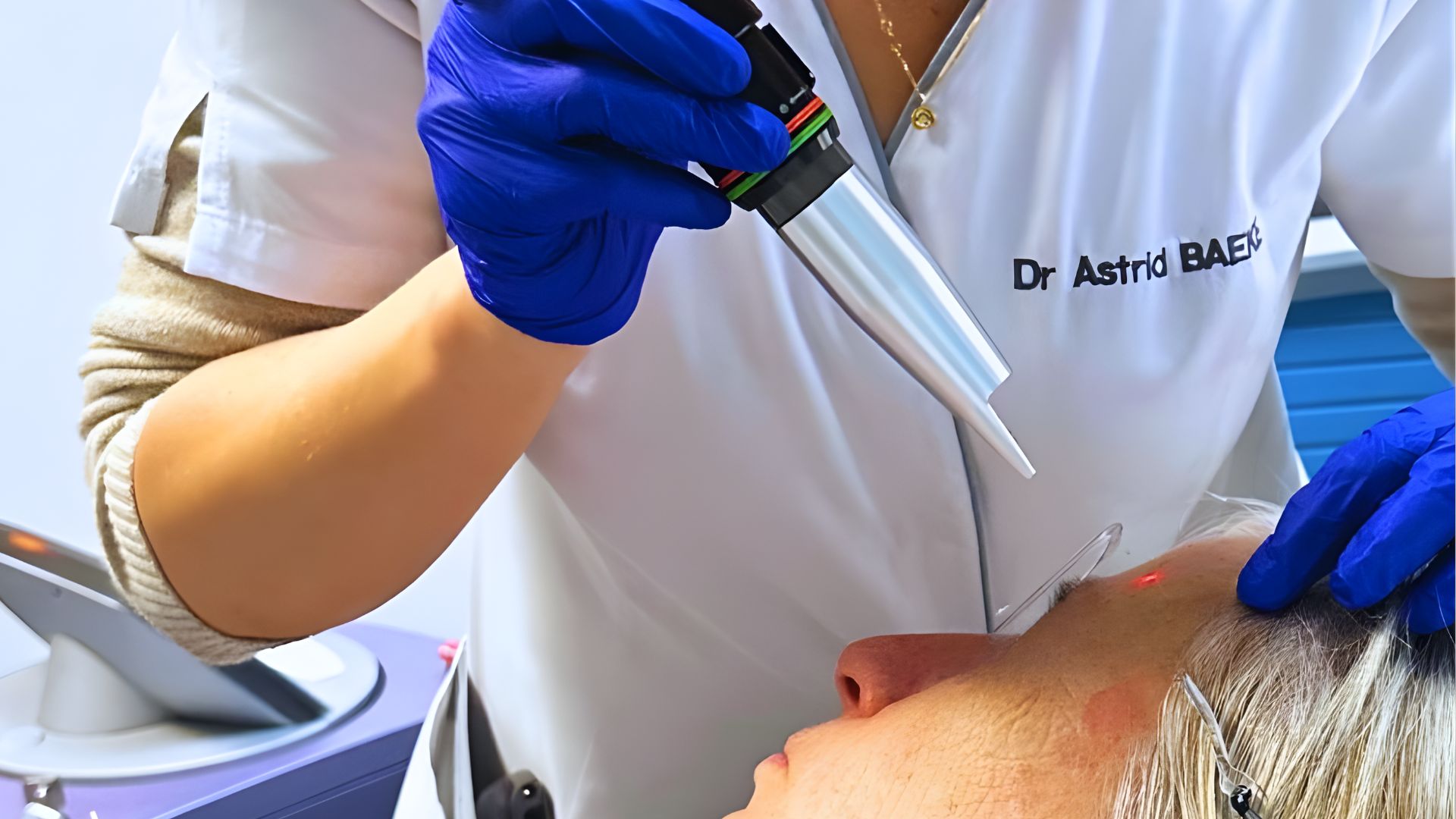 traitement laser lentigos lyon