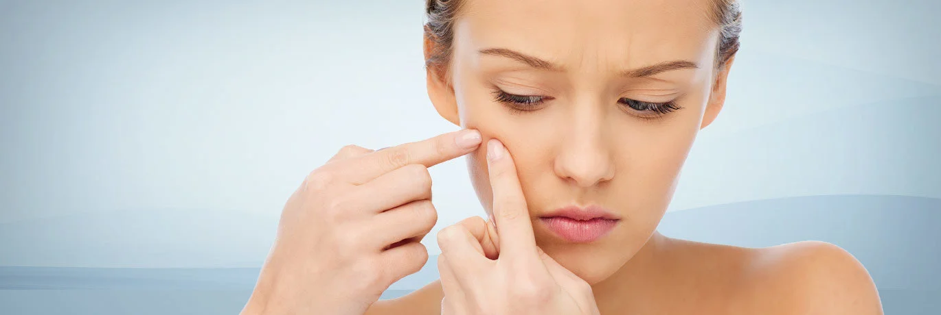 acne traitement laser